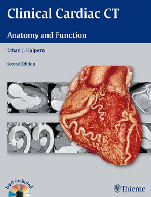 Clinical Cardiac CT (English, Ethan J. Halpern)