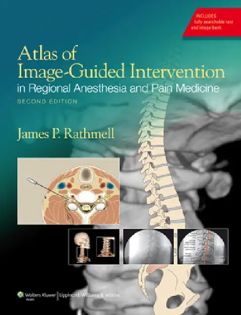 Atlas of Image-Guided Intervention in Regional Anesthesia and Pain Medicine (English, James P. Rathmell)