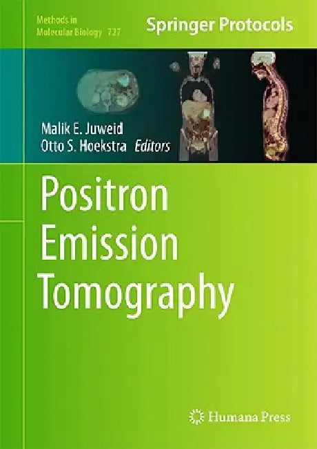 Positron Emission Tomography (English, Malik E. Juweid | Otto S. Hoekstra)