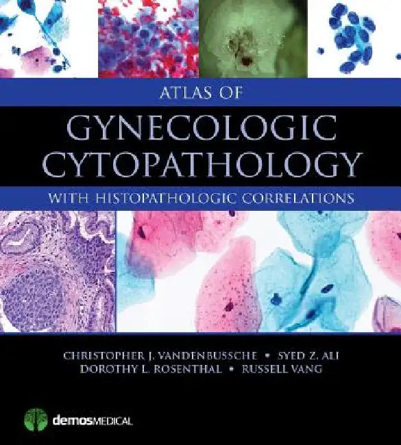 Atlas of Gynecologic Cytopathology (English, Christopher J. Vandenbussche | Syed Z. Ali | Dorothy L. Rosenthal)