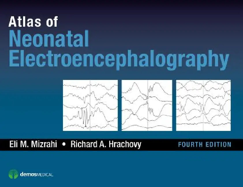 Atlas of Neonatal Electroencephalography (English, Eli M. Mizrahi | Richard A. Hrachovy)