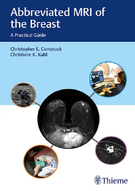 Abbreviated MRI of the Breast (English, Christopher E. Comstock | Christiane Kuhl)