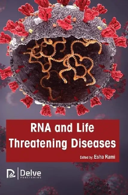 RNA and Life Threatening Diseases (English, Esha Rami)