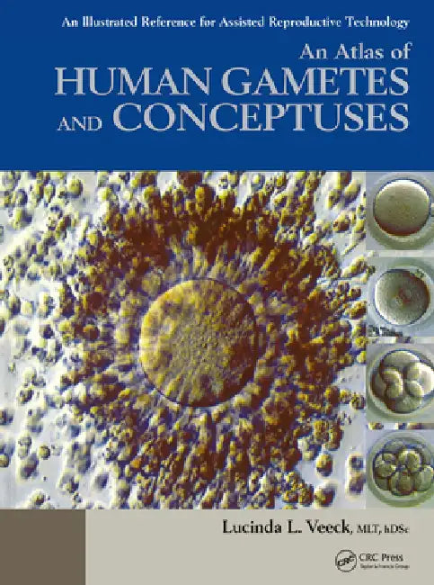 An Atlas of Human Gametes and Conceptuses (English, Lucinda L. Veeck)
