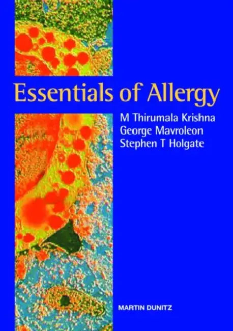 Essentials of Allergy (English, M. Thirumala Krishna | George Mavroleon | Stephen T. Holgate)