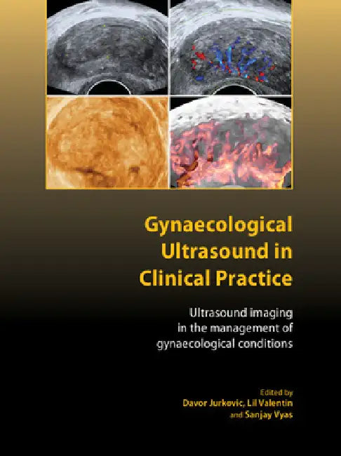 Gynaecological Ultrasound in Clinical Practice (English, Davor Jurkovic | Lil Valentin | Sanjay Vyas)