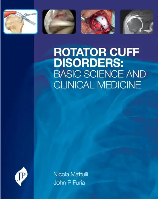 Rotator Cuff Disorders (English, Nicola Maffulli)