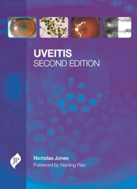 Uveitis With Cd-Rom (English, Nicholas Jones)