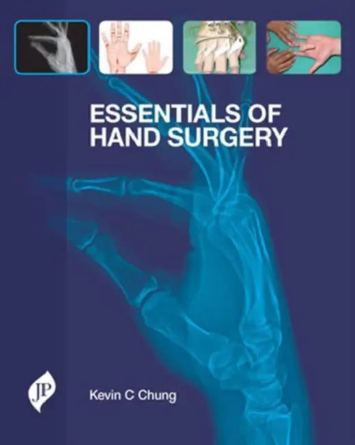 Essentials Of Hand Surgery (English, Kevin C Chung)