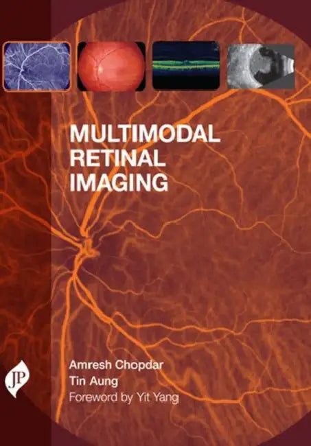Multimodal Retinal Imaging (English, Amresh Chopdar)