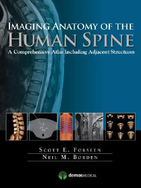 Imaging Anatomy of the Human Spine (English, Scott E. Forseen | Neil M. Borden)