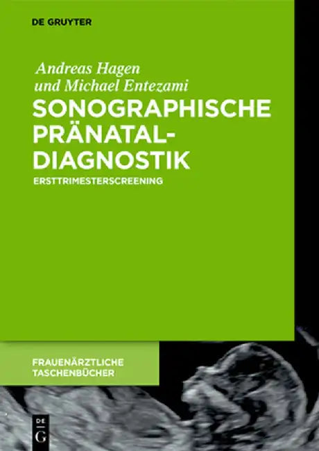 Sonographische Pränataldiagnostik (English, Andreas Hagen)