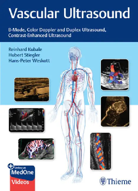 Vascular Ultrasound (English, Reinhard Kubale | Hubert Stiegler | Hans-Peter Weskott)