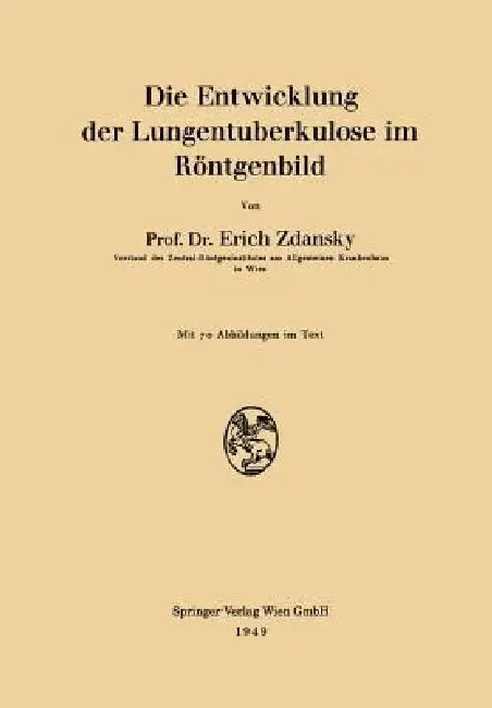 Die Entwicklung Der Lungentuberkulose Im Röntgenbild (English, Erich Zdansky)