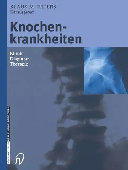 Knochenkrankheiten (English, Klaus M. Peters | P. Eysel)