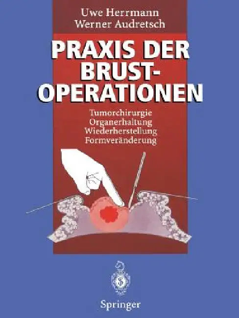 PRAXIS Der Brustoperationen (English, Uwe Herrmann | Werner Audretsch)