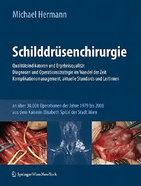 Schilddrüsenchirurgie - Qualitätsindikatoren Und Ergebnisqualität, Diagnosen Und Operationsstrategie (English, Michael Hermann)
