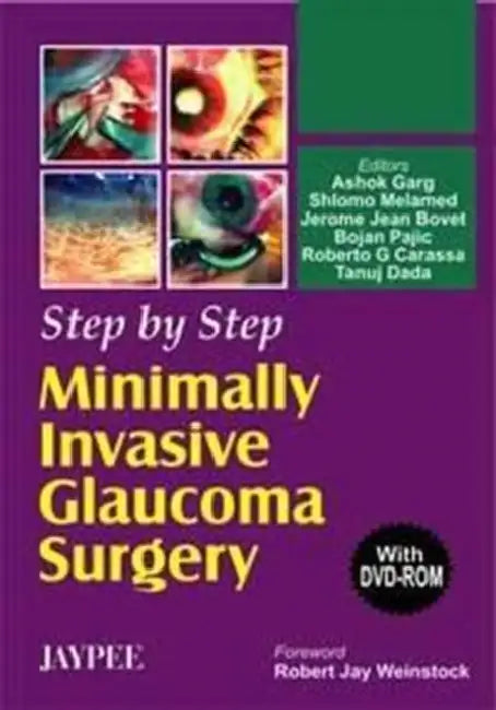 Step By Step Minimally Invasive Glaucoma Surgery With Dvd-Rom (English, Ashok Garg)