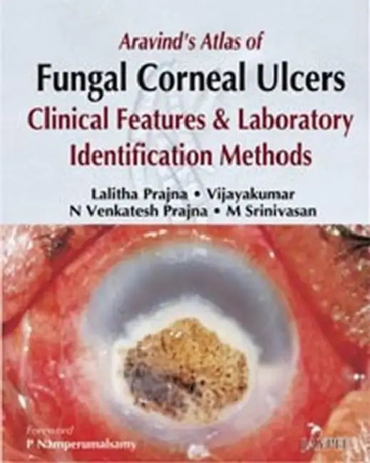 Aravind's Atlas Of Fungal Corneal Ulcers Clinical Features & Lab.Identification Methods (English, Lalitha Prajna)