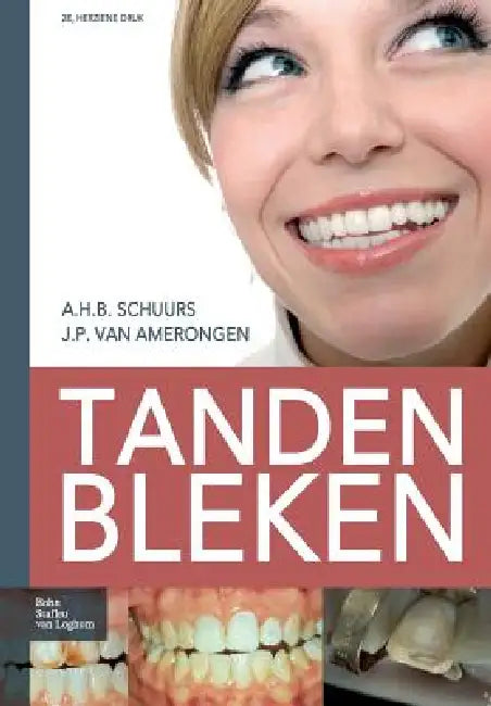Tanden Bleken (English, A. H. B. Schuurs | J. P. Van Amerongen)