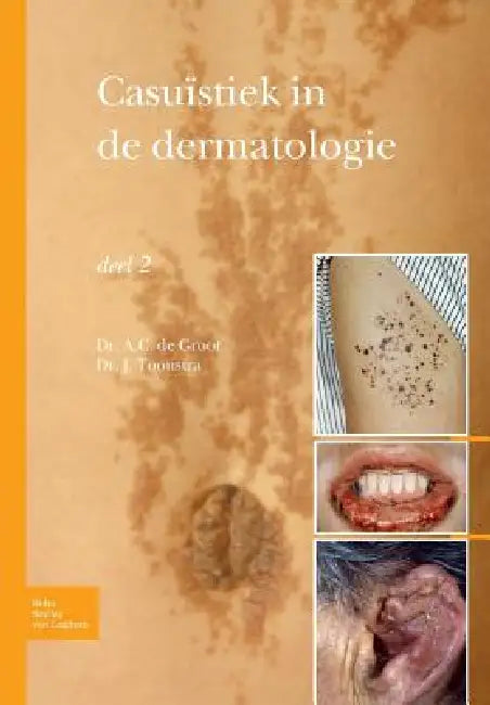 Casuïstiek in de Dermatologie - Deel 2 (English, Johan Toonstra)