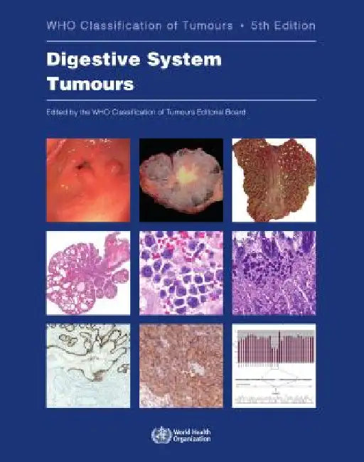 Digestive System Tumours (English, Who Classification of Tumours Editorial)