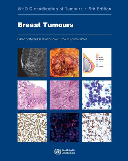 Breast Tumours (English, Who Classification of Tumours Editorial)