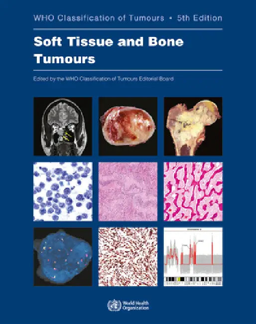 Soft Tissue and Bone Tumours (English, Who Classification of Tumours Editorial)