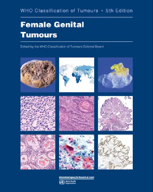 Female Genital Tumours (English, Who Classification of Tumours Editorial)