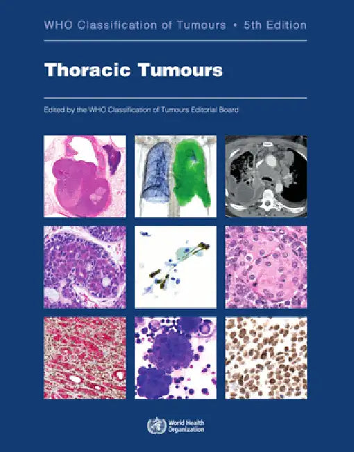 Thoracic Tumours (English, Who Classification of Tumours Editorial)