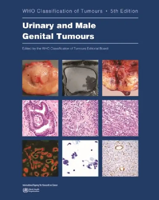 Urinary and Male Genital Tumours (English, Who Classification of Tumours Editorial)