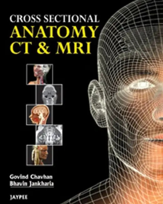 Cross Sectional Anatomy Ct And Mri (English, Govind B Chavhan)
