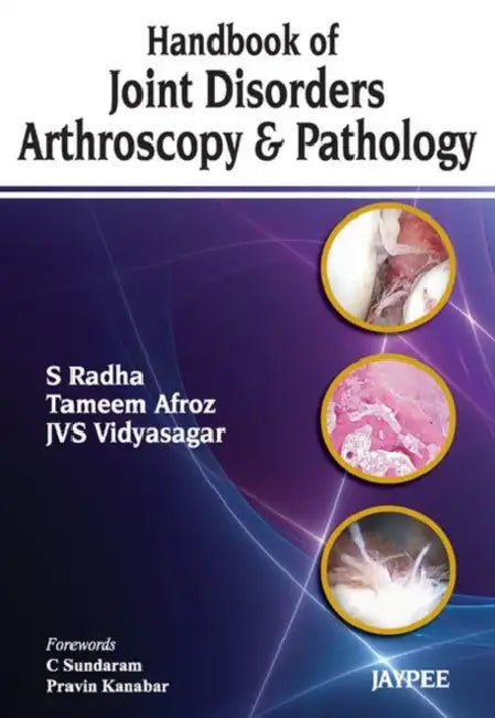 Handbook Of Joint Disorders Arthroscopy & Pathology (English, S Radha)