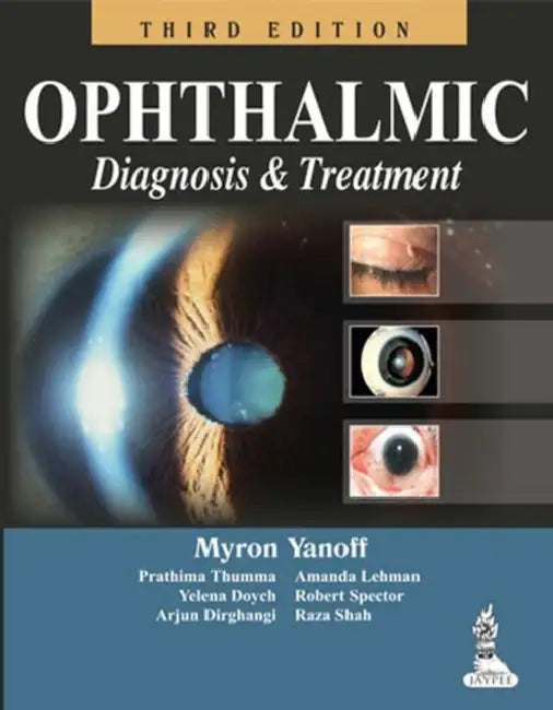 Ophthalmic Diagnosis & Treatment (English, Myron Yanoff)