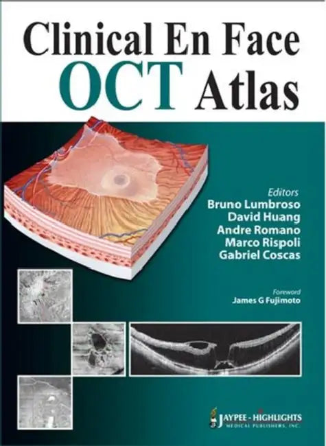 Clinical En Face Oct Atlas (English, Bruno Lumbroso | David Huang | Andre Romano)