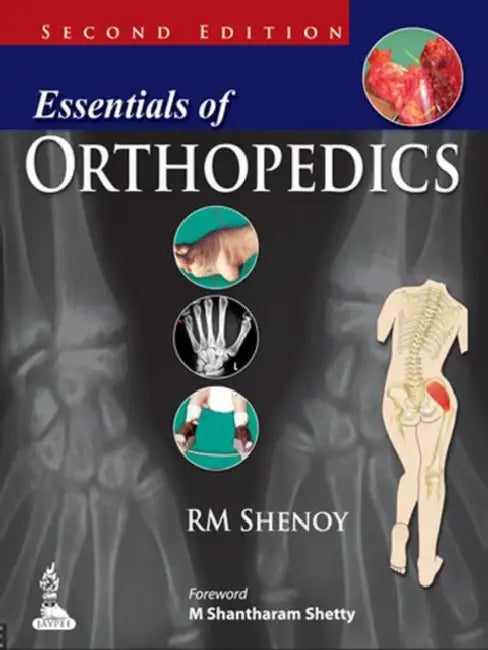 Essentials Of Orthopedics (English, RM Shenoy)
