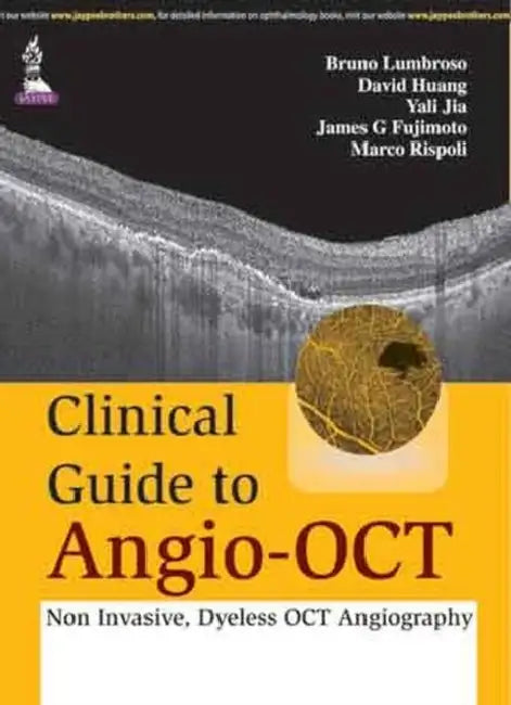 Clinical Guide To Angio-Oct (English, Bruno Lumbroso)