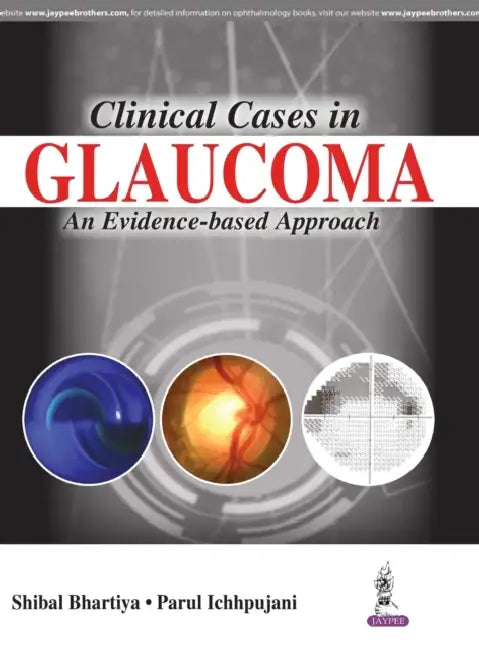 Clinical Cases In Glaucoma An Evidence-Based Approach (English, Shibal Bhartiya)